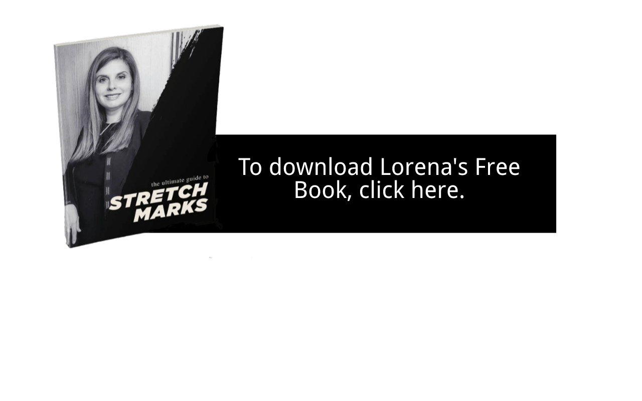 Free Stretch Marks Book