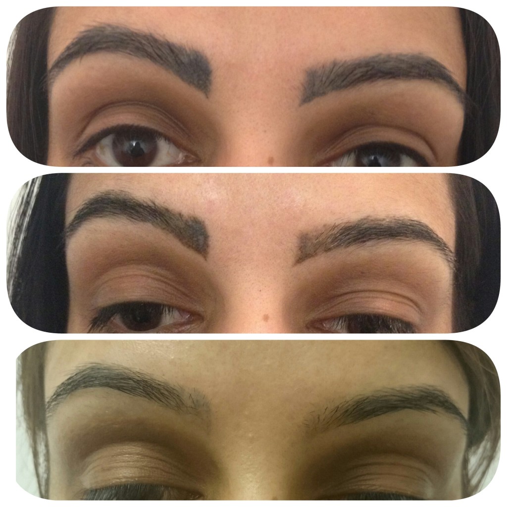 Permanent Makeup Removal Laser Before And After | Fay Blog