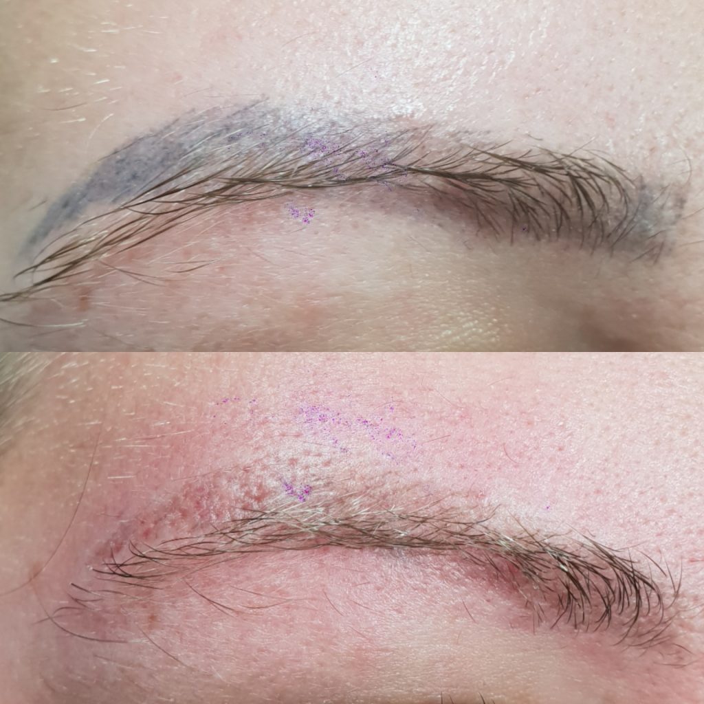 Does permanent makeup fade completely, microblading