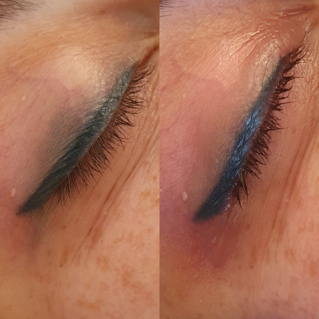 eyeliner removal before and after